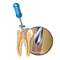 MANI SEC O-FILES K Endodontic Hand Files