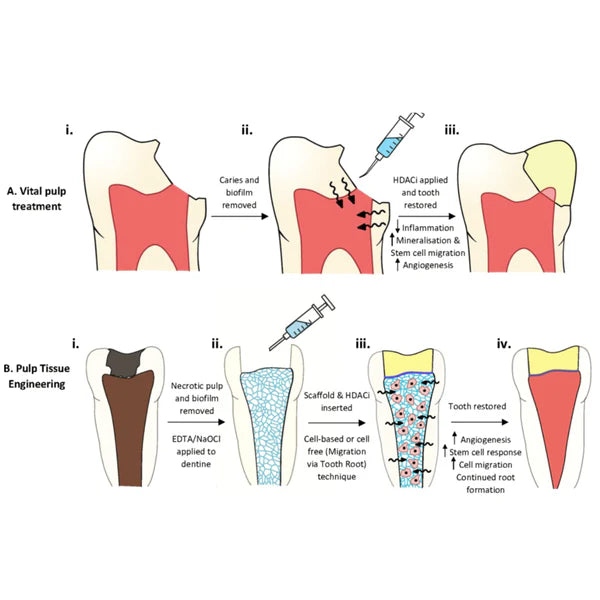 Prevest Dolo EDTA Gel for Root Canals