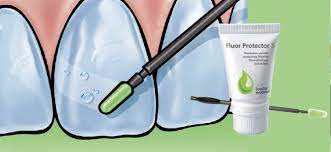 Ivoclar Fluor Protector S Protective Fluoride Varnish